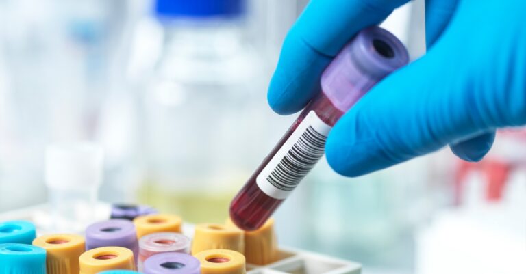First-of-its-kind blood test for head and neck cancer