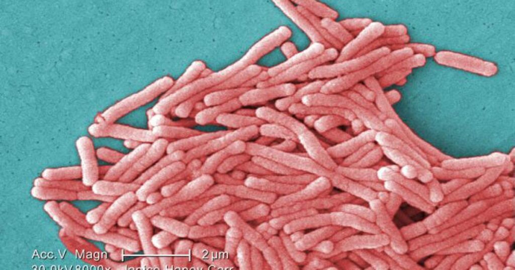 Legionella bacteria confirmed at retirement community following 2 deaths