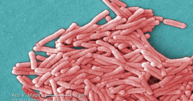 Legionella bacteria confirmed at retirement community following 2 deaths