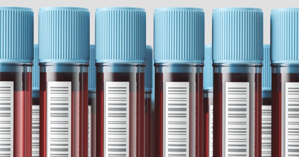 You can order your own blood work now. Interpreting the results is another story