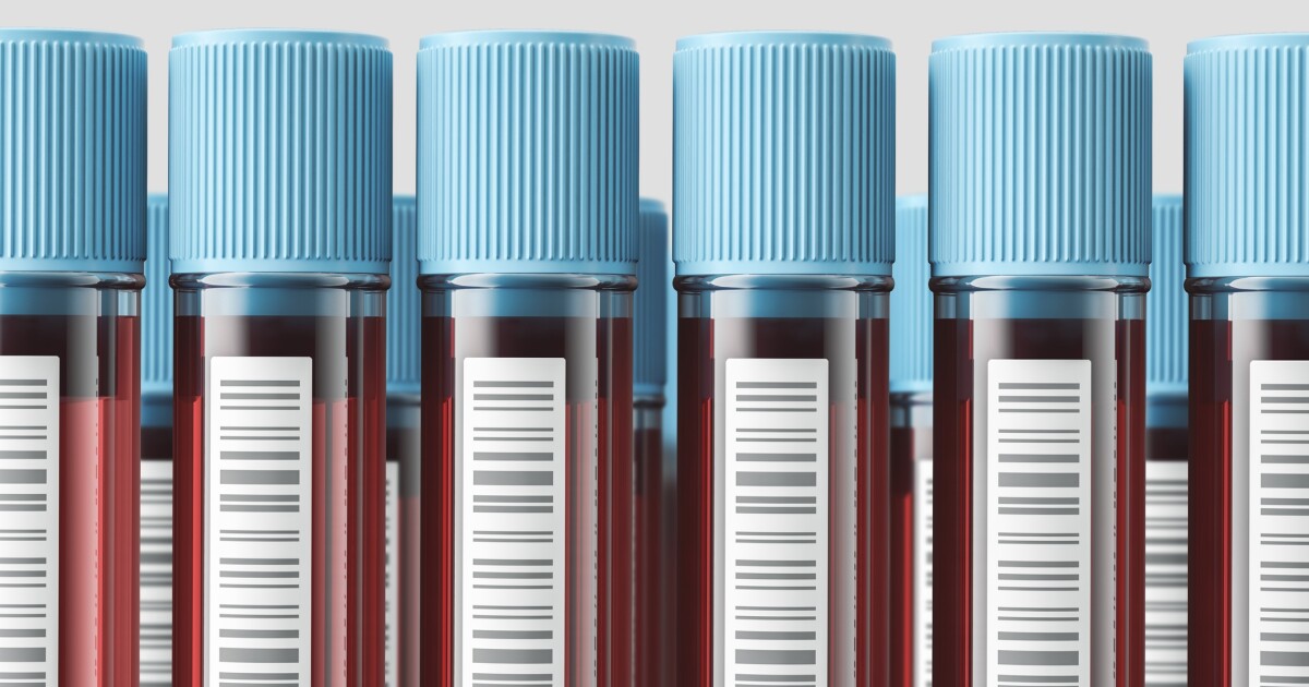 Growing Trend Direct-to-Consumer Blood Testing Gains Popularity - Kitchen Table News You can order your own blood work now. Interpreting the results is another story