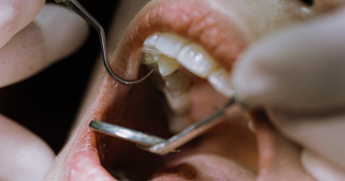 Exploring Oral Bacterias Role in Developing Alzheimers Treatments - Kitchen Table News Could the cure for Alzheimer’s be in our mouths? New trial explores possible link