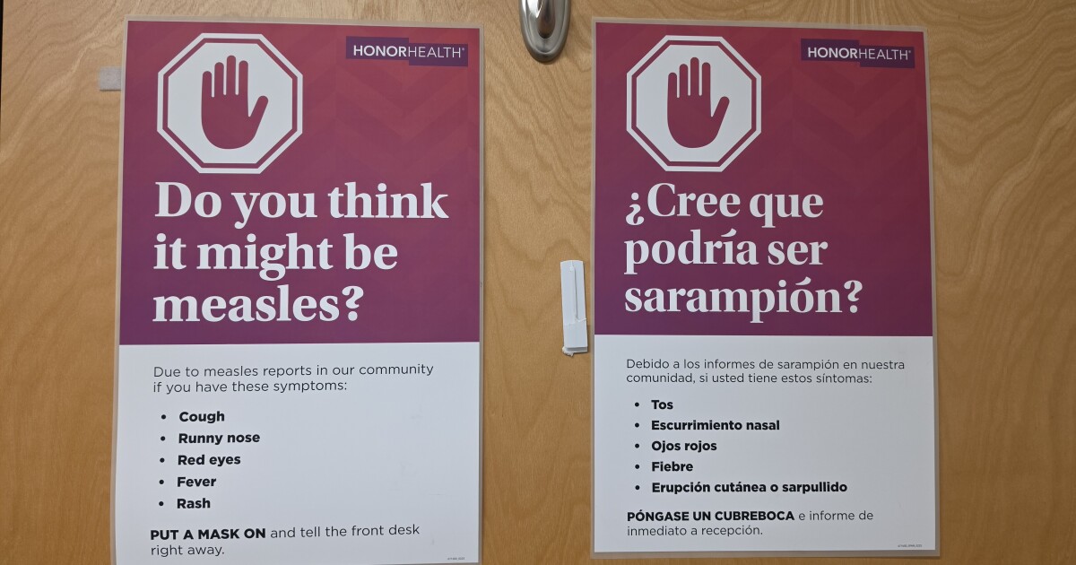 Measles Cases Rise Again in Arizona After Months of Decline - Kitchen Table News Measles continues to spread in Arizona. Confirmed cases increased in June