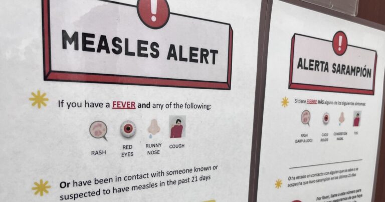 Measles Exposure Alert Issued for Wendy’s Visit in Coolidge, Arizona Measles Exposure Alert Issued for Wendy’s Visit in Coolidge, Arizona