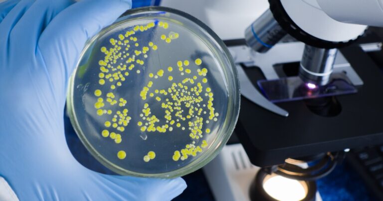 Michigan Cyclosporiasis Outbreak Sickens Over 170; Source Unknown Michigan Cyclosporiasis Outbreak Sickens Over 170; Source Unknown