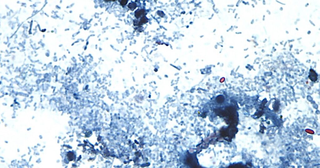 Michigan Faces Largest Cyclospora Outbreak in State’s History
