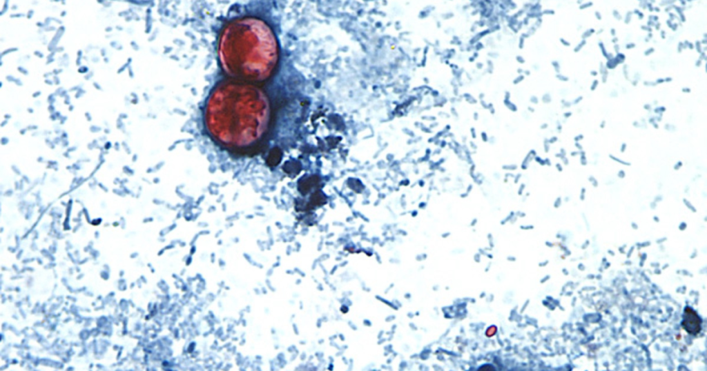 Michigan reports the first 2 US deaths related to a diarrhea-causing parasite