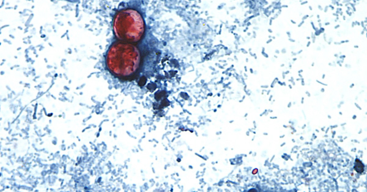 Michigan reports the first 2 US deaths related to a diarrhea-causing parasite